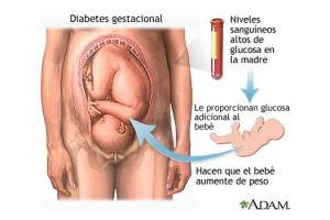 Diabetes-gestacional-ADAM