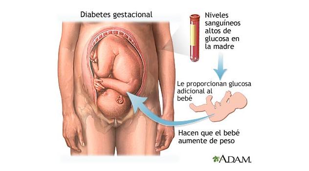 Diabetes-gestacional-ADAM