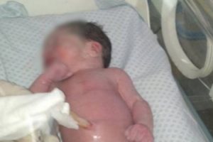 MS POLICÍAS ASISTIERON A RECIÉN NACIDA ABANDONADA EN LA CALLE CON PRINCIPIO DE HIPOTERMIA