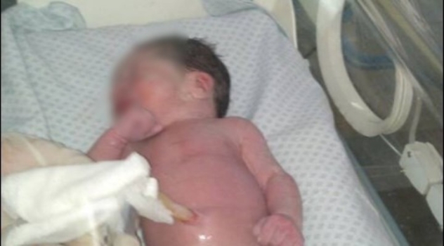 MS POLICÍAS ASISTIERON A RECIÉN NACIDA ABANDONADA EN LA CALLE CON PRINCIPIO DE HIPOTERMIA