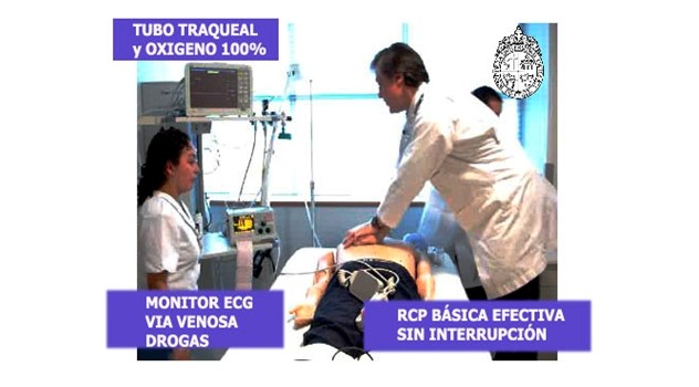 ab tubo_traqueal_monitor