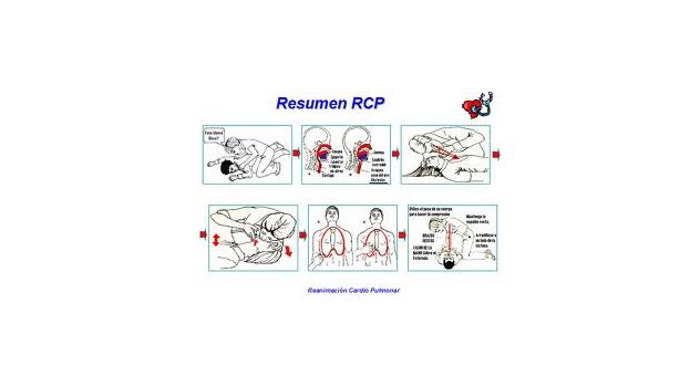 rcp